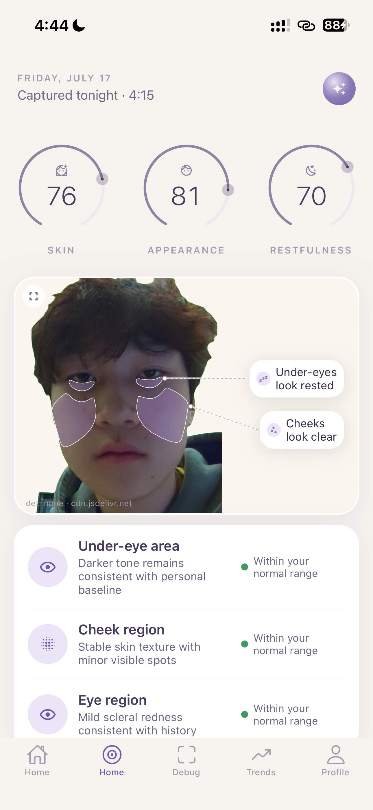 Mirra app daily wellness insights